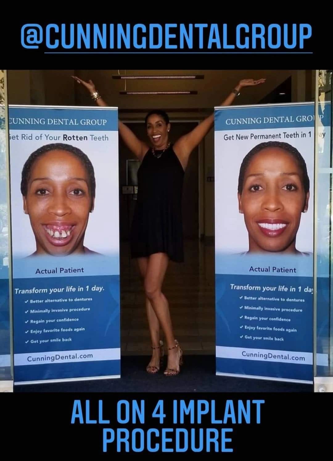 Coach Peters between two Cunning Dental Group banners showing her before-and-after smile from the All-on-4 implant procedure.